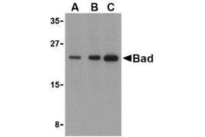 Western blot analysis of Bad in T24 cell lysates with AP30114PU-N Bad antibody at (A) 0. (BAD 抗体)