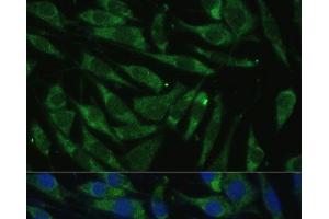 Immunofluorescence analysis of L929 cells using PITRM1 Polyclonal Antibody at dilution of 1:100 (40x lens). (PITRM1 抗体)