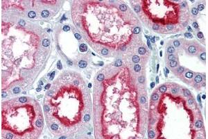 Human Kidney (formalin-fixed, paraffin-embedded) stained with ACE antibody ABIN337280 at 10 ug/ml followed by biotinylated anti-mouse IgG secondary antibody ABIN481714, alkaline phosphatase-streptavidin and chromogen. (Angiotensin I Converting Enzyme 1 抗体)