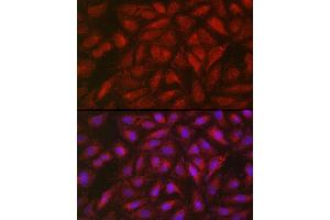 Immunofluorescence analysis of U2OS cells using SOCS3 Rabbit pAb (ABIN3015316, ABIN3015317, ABIN5663764 and ABIN6213984) at dilution of 1:50 (40x lens). (SOCS3 抗体  (C-Term))