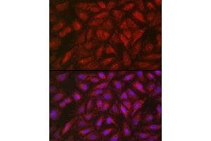 Immunofluorescence analysis of U2OS cells using SOCS3 Rabbit pAb (ABIN3015316, ABIN3015317, ABIN5663764 and ABIN6213984) at dilution of 1:50 (40x lens). (SOCS3 抗体  (C-Term))