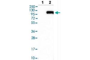 Western blot analysis of Lane 1: Negative control (vector only transfected HEK293T lysate), Lane 2: Over-expression lysate (Co-expressed with a C-terminal myc-DDK tag (~3. (Fibulin 1 抗体  (AA 266-402))