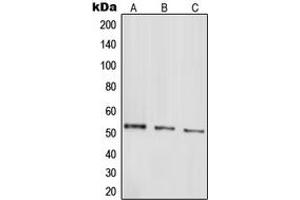 Western blot analysis of Parkin expression in HepG2 (A), SHSY5Y (B), SW480 (C) whole cell lysates. (Parkin 抗体  (N-Term))