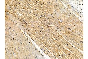 ABIN7095772 and ABIN7099834 at 1/100 staining rat muscle tissue by IHC-P. (Slc38a5 抗体)