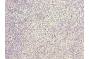 Immunohistochemistry of paraffin-embedded human tonsil tissue using ABIN7156460 at dilution of 1:100 (ITGAL 抗体  (AA 201-500))