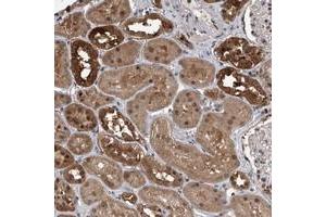 Immunohistochemical staining of human kidney with BHLHE23 polyclonal antibody  shows strong cytoplasmic and nuclear positivity in cells in tubules at 1:10-1:20 dilution. (BHLHE23 抗体)
