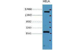 Western Blot (WB) analysis of HeLa, diluted at 1:2000. (CD45 抗体)