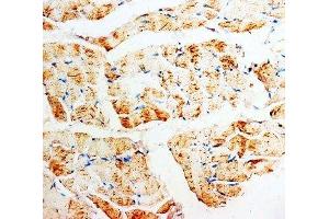 IHC-P: PMVK antibody testing of rat skeletal muscle tissue (PMVK 抗体  (Middle Region))