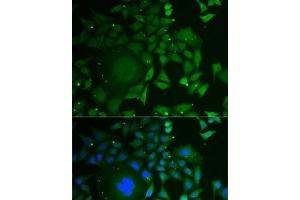 Immunofluorescence analysis of U2OS cells using C1D Polyclonal Antibody (C1D 抗体)