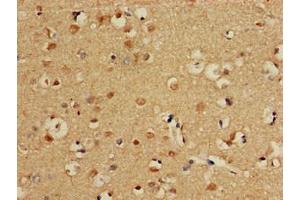 Immunohistochemistry of paraffin-embedded human brain tissue using ABIN7146829 at dilution of 1:100 (CPT1C 抗体  (AA 699-803))