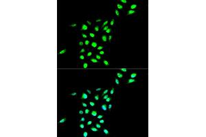 Immunofluorescence analysis of A549 cell using VCP antibody. (VCP 抗体)