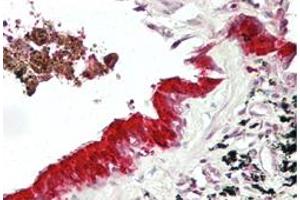 Immunohistochemical staining (Formalin-fixed paraffin-embedded sections) of human lung with MXI1 polyclonal antibody  at 4-8 ug/mL working concentration. (MXI1 抗体  (Internal Region))