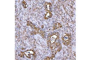 IHC analysis of Syntaxin 18/STX18 using anti-Syntaxin 18/STX18 antibody (ABIN7599259).