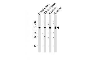 Western Blotting (WB) image for anti-Immunoglobulin Heavy Constant gamma 1 (G1m Marker) (IGHG1) (AA 74-102) antibody (ABIN655605)
