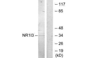 Western Blotting (WB) image for anti-Nuclear Receptor Subfamily 1, Group I, Member 3 (NR1I3) (Internal Region) antibody (ABIN1849606) (NR1I3 抗体  (Internal Region))