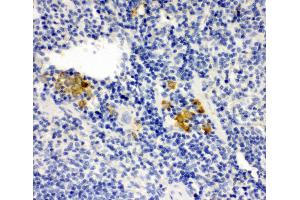Anti-Leupaxin antibody, IHC(P) IHC(P): Mouse Spleen Tissue (Leupaxin 抗体  (N-Term))