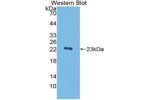 Detection of Recombinant PGLYRP1, Mouse using Polyclonal Antibody to Peptidoglycan Recognition Protein 1 (PGLYRP1) (PGLYRP1 抗体  (AA 19-182))