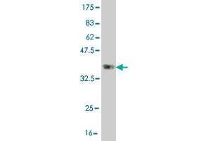 Western Blot detection against Immunogen (36. (CLCA2 抗体  (AA 300-400))