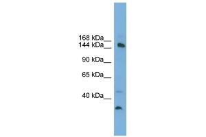 WB Suggested Anti-MED14 Antibody Titration: 0. (MED14 抗体  (Middle Region))