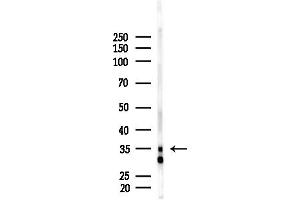 Western blot analysis of lysates from F10-LUC cells(LPS, 4h treatment), using OR4C45 Antibody at 1/1000 dilution.