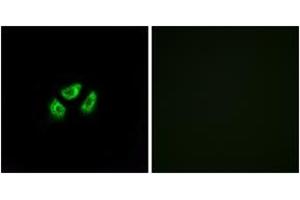 Immunofluorescence analysis of A549 cells, using SCN7A Antibody.