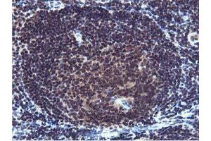 Image no. 1 for anti-Cystatin SA (CST2) antibody (ABIN1497759) (CST2 抗体)