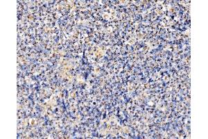 IHC analysis of PMPCA/INPP5 using anti-PMPCA/INPP5 antibody (ABIN7602722). (PMPCA 抗体  (AA 99-525))