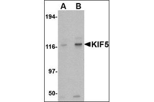 Western blot analysis of KIF5 in K562 cell lysate with this product at (A) 0. (KIF5A 抗体  (Center))