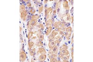 Immunohistochemical analysis of paraffin-embedded H. (TXN 抗体  (C-Term))