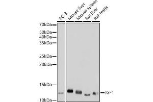 Western blot analysis of extracts of various cell lines, using IGF1 antibody (ABIN1682184, ABIN3015345, ABIN3015346 and ABIN7101347) at 1:1000 dilution. (IGF1 抗体)