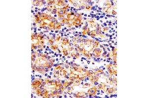 Immunohistochemistry (Paraffin-embedded Sections) (IHC (p)) image for anti-Solute Carrier Family 22 (Organic Cation Transporter), Member 2 (SLC22A2) (AA 57-89), (N-Term) antibody (ABIN6242877)