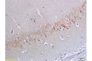 Formalin-fixed and paraffin embedded rat brain labeled with Anti-ApoER2 Polyclonal Antibody, Unconjugated (ABIN719426) at 1:200 followed by conjugation to the secondary antibody and DAB staining (LRP8 抗体  (AA 851-963))
