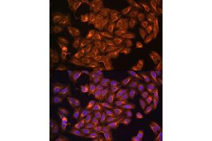 Immunofluorescence (IF) image for anti-Neurofibromin 2 (NF2) (AA 477-576) antibody (ABIN6144548)