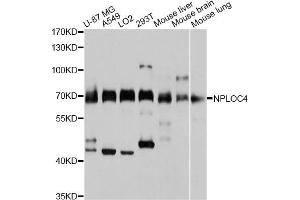 Western blot analysis of extracts of various cell lines, using NPLOC4 antibody (ABIN4904565) at 1:3000 dilution. (NPLOC4 抗体)