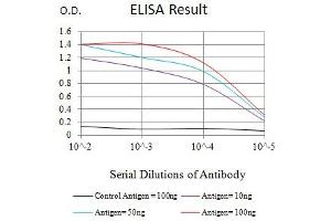 Black line: Control Antigen (100 ng),Purple line: Antigen (10 ng), Blue line: Antigen (50 ng), Red line:Antigen (100 ng) (Mesothelin 抗体  (AA 296-606))