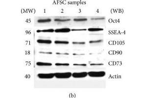 Effect of donor heterogeneity on stem cells markers. (CD73 抗体)