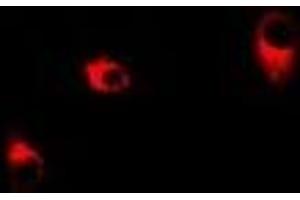 Immunofluorescent analysis of Transaldolase staining in Hela cells. (TALDO1 抗体)