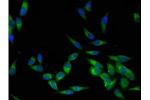 Immunofluorescent analysis of Hela cells using ABIN7174038 at dilution of 1:100 and Alexa Fluor 488-congugated AffiniPure Goat Anti-Rabbit IgG(H+L) (LCK 抗体  (AA 1-539))