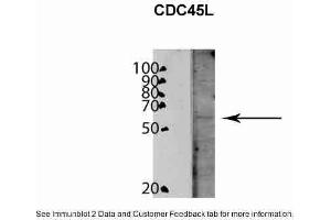 WB Suggested Anti-CDC45L Antibody Titration: 0. (CDC45 抗体  (C-Term))