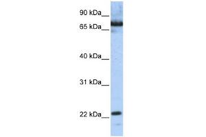 WB Suggested Anti-SCAND1 Antibody Titration:  0. (SCAND1 抗体  (N-Term))