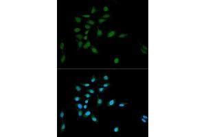 Immunofluorescence (IF) image for anti-Proteasome Subunit alpha Type 1 (PSMA1) (AA 1-263) antibody (ABIN3016184)