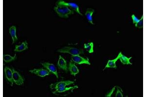 Immunofluorescent analysis of Hela cells using ABIN7165680 at dilution of 1:100 and Alexa Fluor 488-congugated AffiniPure Goat Anti-Rabbit IgG(H+L) (PKC alpha 抗体  (AA 495-659))