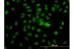 Immunofluorescence of monoclonal antibody to CSE1L on HeLa cell. (Exportin 2 抗体  (AA 872-971))