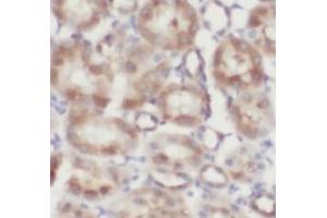 IHC-P analysis of human kidney tissue, using FOLR1 antibody (1/200).