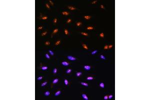 Immunofluorescence analysis of U2OS cells using LYAR Rabbit pAb  at dilution of 1:100. (LYAR 抗体  (AA 10-160))
