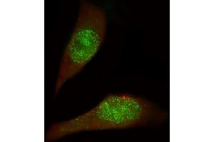 Immunofluorescent analysis of 4 % paraformaldehyde-fixed, 0. (USP27X 抗体  (AA 1-30))