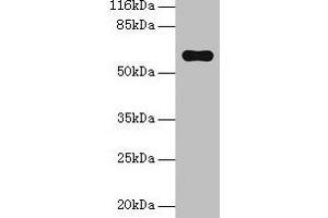 Western blot All lanes: Pklr antibody at 2 μg/mL + Hela whole cell lysate Secondary Goat polyclonal to rabbit IgG at 1/10000 dilution Predicted band size: 63, 59 kDa Observed band size: 63 kDa (PKLR 抗体  (AA 1-574))