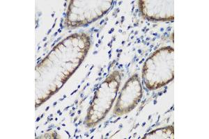 Immunohistochemistry of paraffin-embedded human stomach using TTBK2 antibody (ABIN6131392, ABIN6149666, ABIN6149669 and ABIN6223523) at dilution of 1:200 (40x lens). (TTBK2 抗体  (AA 1185-1244))
