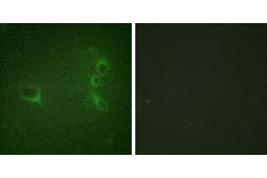 P-peptide - +Immunofluorescence analysis of NIH/3T3 cells, using Bcr (Phospho-Tyr360) antibody. (BCR 抗体  (pTyr360))