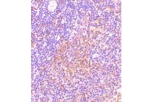 Immunohistochemistry of TANK in rat spleen tissue with this product at 10 μg/ml.